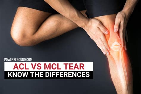 acl mcl tear test|acl vs mcl tear symptoms.